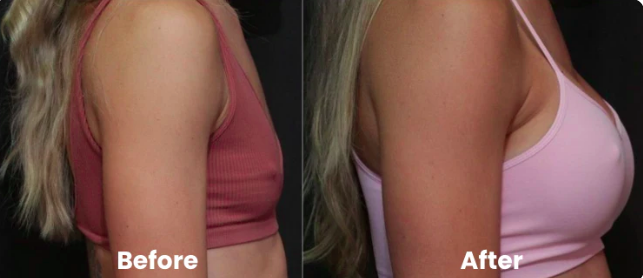 Perki - Breast Enhancement Patches